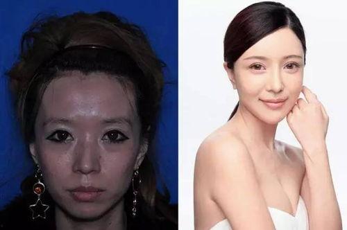 吃瓜整容的女人,吃瓜群众眼中的整容美女
